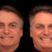 bolsonaro harmonizacao